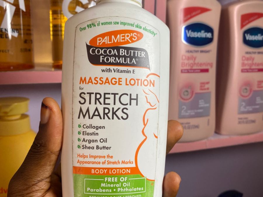 Palmers stretch mark